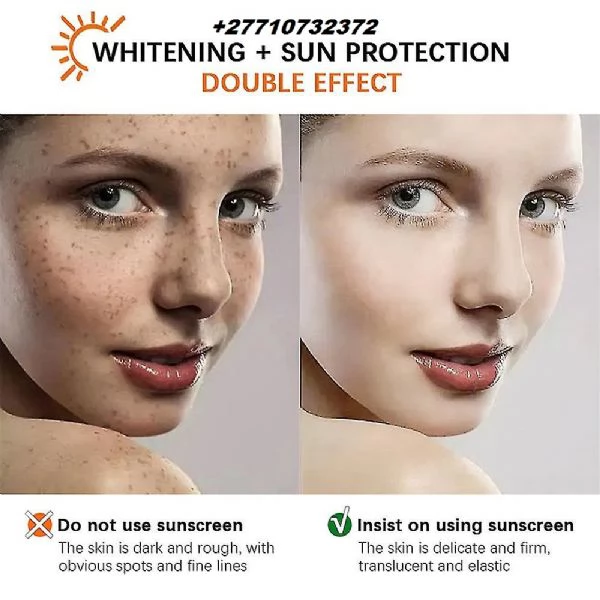 Skin Whitening In Tabora Municipality in Tanzania, Pimple Treatment In Newton City in Massachusetts