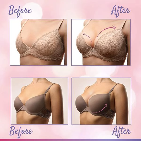 Breast Enlargement In Lexington Town in Massachusetts, Breast Lifting In Kigoma City in Tanzania | Foto 4